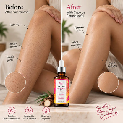 Cyperus Rotundus Oil™ | Hair Removal & Hair Reduction